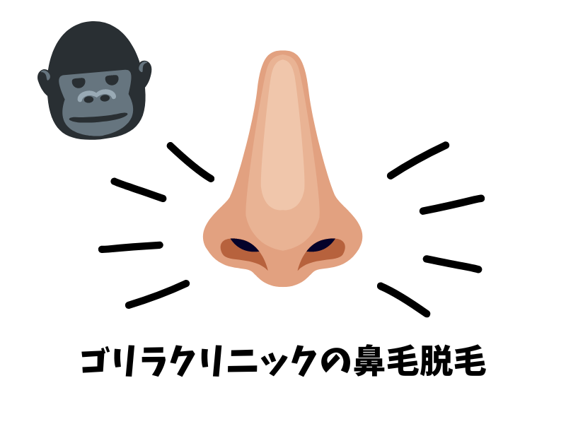 ゴリラクリニックの鼻毛脱毛とは