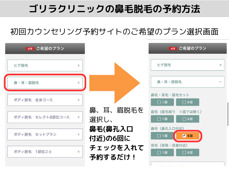 ゴリラクリニックの鼻毛脱毛の予約方法