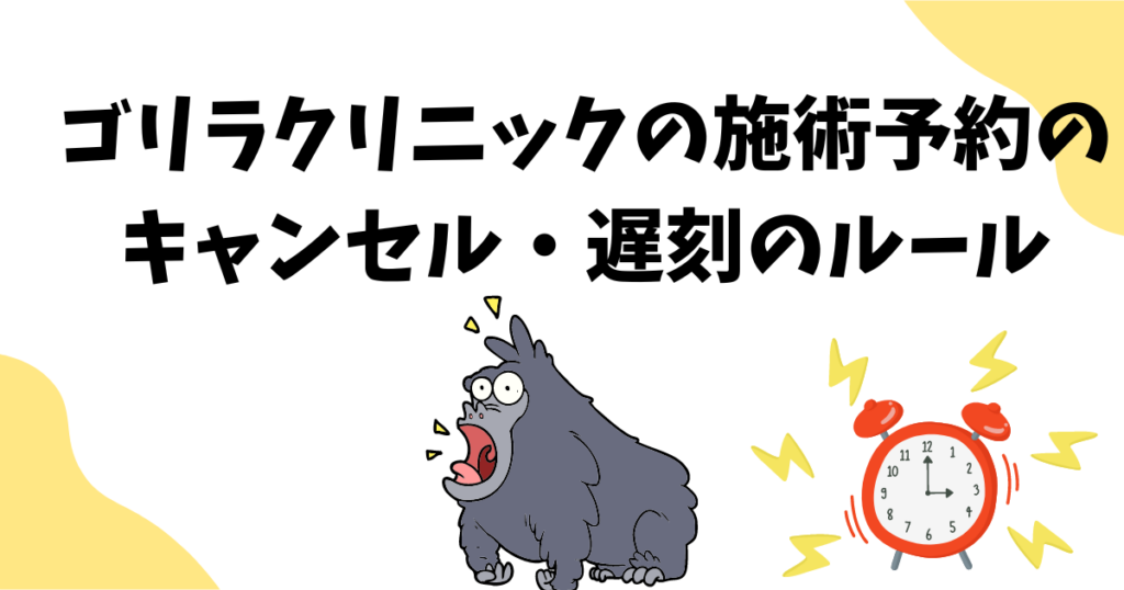 ゴリラクリニックの予約キャンセル規定4つを解説！遅刻とキャンセルポリシーについて