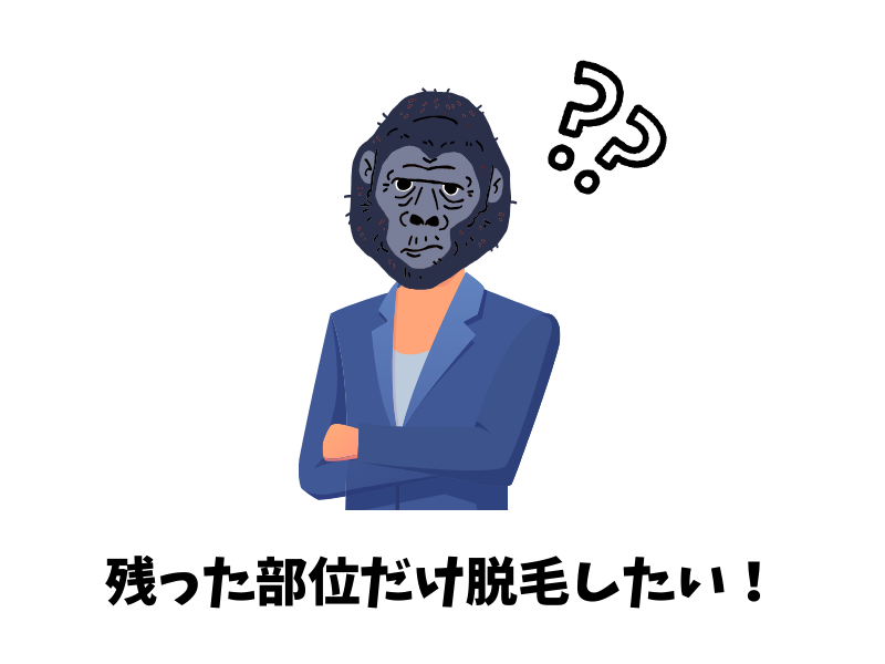ゴリラクリニックの全身脱毛コース終了後に、残った部位だけ追加脱毛