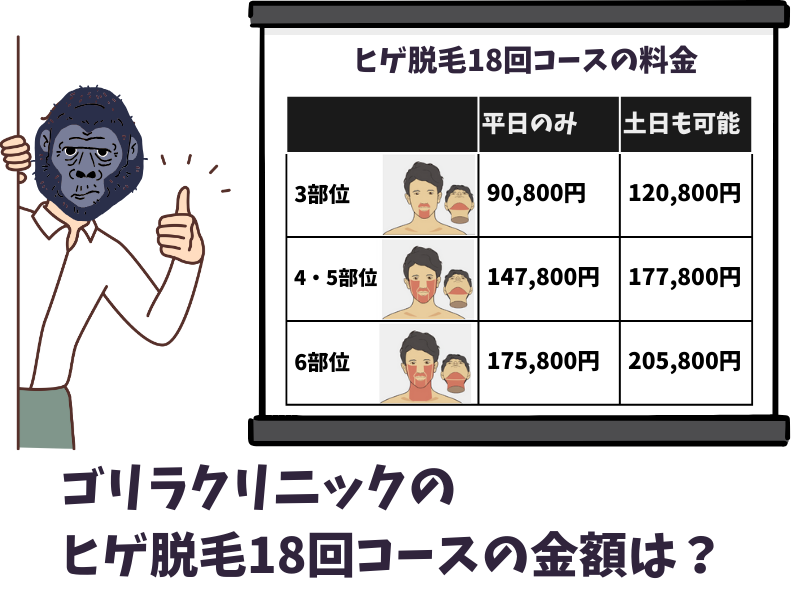 ゴリラクリニックのヒゲ脱毛18回コースの金額はいくら？