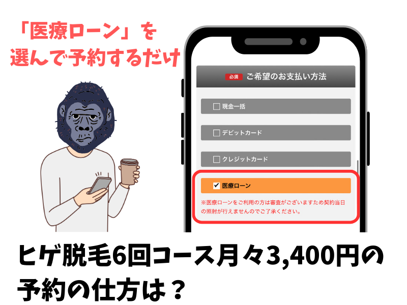 ゴリラクリニックのヒゲ脱毛6回コース月々3,400円の予約の仕方は？