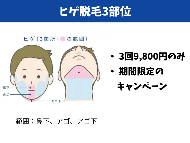 ヒゲ脱毛3部位コース