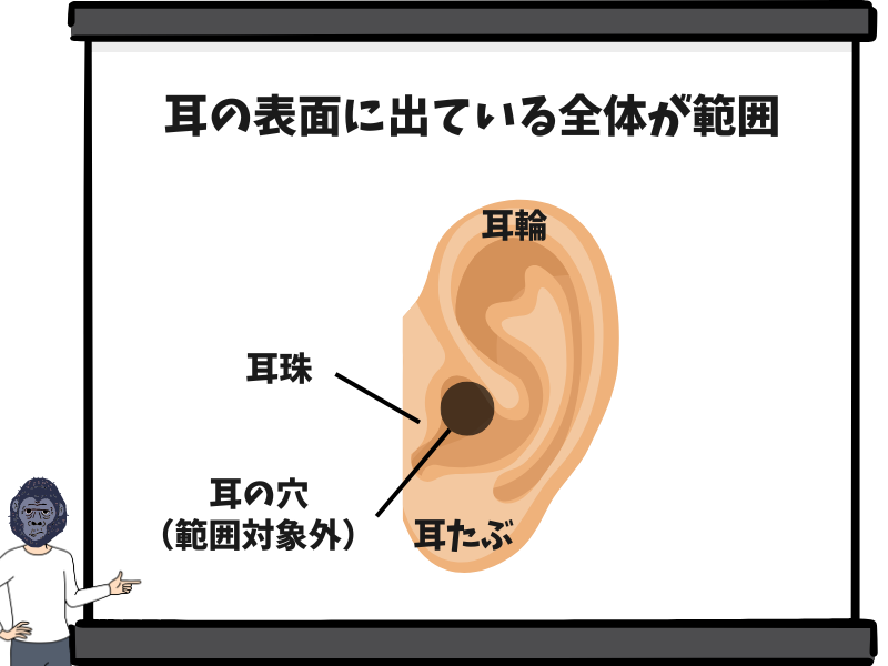 ゴリラクリニックの耳毛脱毛の範囲