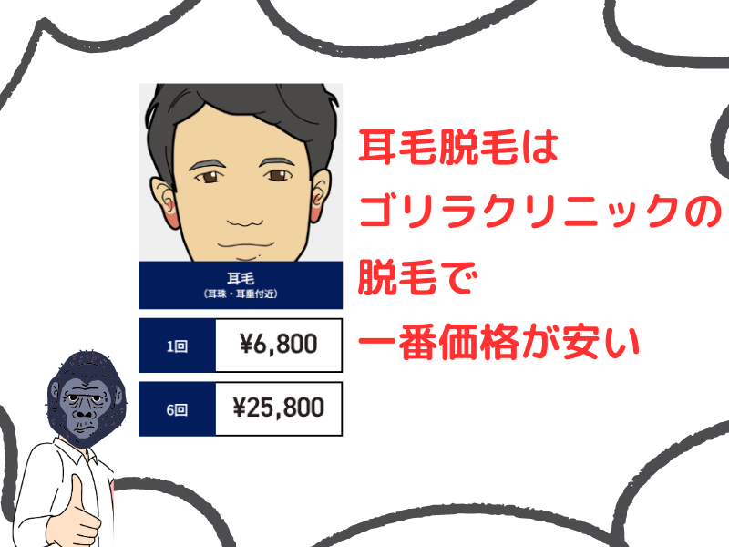 ゴリラクリニックの耳毛脱毛の金額